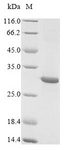 L-rhamnose-binding lectin CSL3 Protein - (Tris-Glycine gel) Discontinuous SDS-PAGE (reduced) with 5% enrichment gel and 15% separation gel.