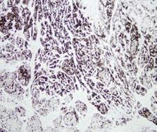Chymotrypsin Antibody - Paraffin-embedded human pancreas.