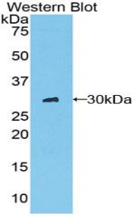 Chymotrypsin C Antibody - Western blot of recombinant Chymotrypsin.  This image was taken for the unconjugated form of this product. Other forms have not been tested.