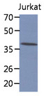 CIAO1 Antibody - Western Blot: The cell lysate of Jurkat (30 ug) were resolved by SDS-PAGE, transferred to PVDF membrane and probed with anti-human CIAO1 antibody (1:1000). Proteins were visualized using a goat anti-mouse secondary antibody conjugated to HRP and an ECL detection system.