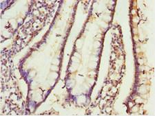 CIAO1 Antibody - Immunohistochemistry of paraffin-embedded human small intestine tissue at dilution 1:100