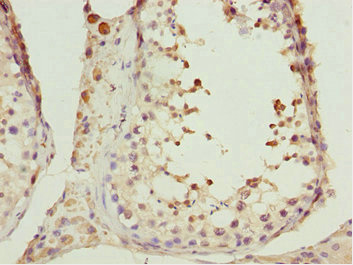 CIAO1 Antibody - Immunohistochemistry of paraffin-embedded human testis tissue at dilution 1:100