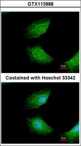 CIAPIN1 / Anamorsin Antibody - Immunofluorescence of methanol-fixed HeLa using CIAPIN1 antibody at 1:200 dilution.