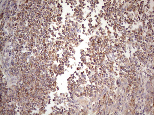 CIAPIN1 / Anamorsin Antibody - Immunohistochemical staining of paraffin-embedded Human tonsil within the normal limits using anti-CIAPIN1 mouse monoclonal antibody. (Heat-induced epitope retrieval by 1mM EDTA in 10mM Tris buffer. (pH8.5) at 120°C for 3 min. (1:150)
