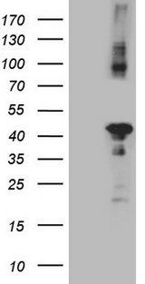CIAPIN1 / Anamorsin Antibody - HEK293T cells were transfected with the pCMV6-ENTRY control. (Left lane) or pCMV6-ENTRY CIAPIN1. (Right lane) cDNA for 48 hrs and lysed