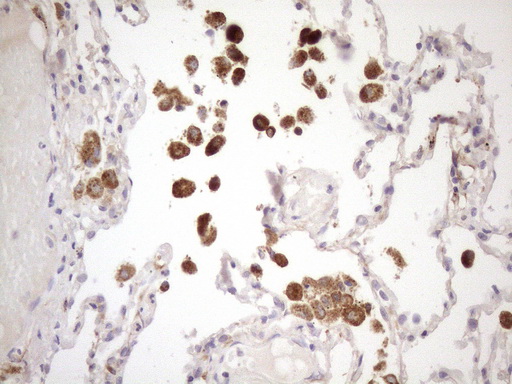 CIAPIN1 / Anamorsin Antibody - Immunohistochemical staining of paraffin-embedded Human lung tissue within the normal limits using anti-CIAPIN1 mouse monoclonal antibody. (Heat-induced epitope retrieval by 1mM EDTA in 10mM Tris buffer. (pH8.5) at 120°C for 3 min. (1:150)