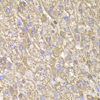 CIAPIN1 / Anamorsin Antibody - Immunohistochemistry of paraffin-embedded Human liver injury tissue.