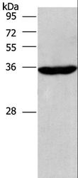 CIAPIN1 / Anamorsin Antibody - Western blot analysis of Raji cell, using CIAPIN1 Polyclonal Antibody at dilution of 1:597.