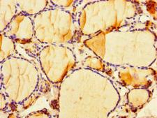 CIART / C1orf51 Antibody - Immunohistochemistry of paraffin-embedded human thyroid tissue using CIART Antibody at dilution of 1:100