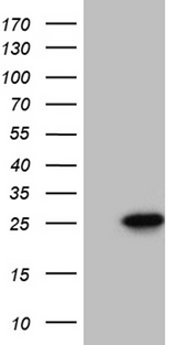 CIB1 / KIP Antibody - HEK293T cells were transfected with the pCMV6-ENTRY control. (Left lane) or pCMV6-ENTRY CIB1. (Right lane) cDNA for 48 hrs and lysed