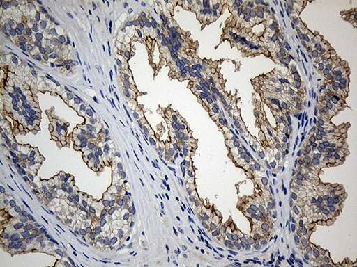 CIB1 / KIP Antibody - Immunohistochemical staining of paraffin-embedded Human prostate tissue within the normal limits using anti-CIB1 mouse monoclonal antibody. (Heat-induced epitope retrieval by 1mM EDTA in 10mM Tris buffer. (pH8.5) at 120°C for 3 min. (1:500)