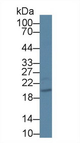 CIB1 / KIP Antibody - Western Blot; Sample: Human HepG2 cell lysate; Primary Ab: 1µg/ml Rabbit Anti-Human CIB1 Antibody Second Ab: 0.2µg/mL HRP-Linked Caprine Anti-Rabbit IgG Polyclonal Antibody