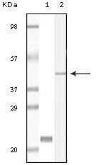 CIB1 / KIP Antibody - Calmyrin Antibody in Western Blot (WB)