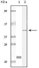 CIB1 / KIP Antibody - Western blot using CIB1 mouse monoclonal antibody against truncated CIB1 recombinant protein (1) and A431 cell lysate (2).