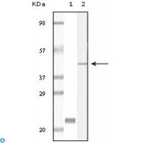 CIB1 / KIP Antibody - Immunohistochemistry (IHC) analysis of paraffin-embedded human thalamus (left) and glioma (right) tissue, showing membrane localization with DAB staining using CIB1 Monoclonal Antibody.
