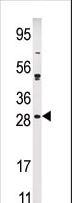 CIB2 / KIP2 Antibody - Western blot of anti-KIP2 antibody in Ramos cell line lysate (35 ug/lane). KIP2(arrow) was detected using the purified Pab