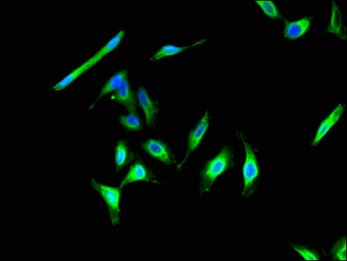 CIB2 / KIP2 Antibody - Immunofluorescent analysis of Hela cells using CIB2 Antibody at a dilution of 1:100 and Alexa Fluor 488-congugated AffiniPure Goat Anti-Rabbit IgG(H+L)
