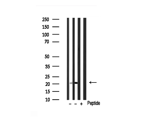 CIB2 / KIP2 Antibody - Western blot analysis of CIB2 antibody expression in Various tissues lysates. The lane on the right is treated with the antigen-specific peptide.