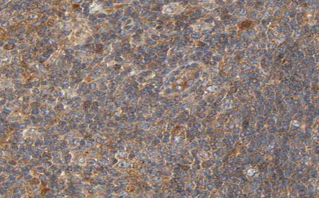CIB2 / KIP2 Antibody - 1:100 staining human lymph node tissue by IHC-P. The tissue was formaldehyde fixed and a heat mediated antigen retrieval step in citrate buffer was performed. The tissue was then blocked and incubated with the antibody for 1.5 hours at 22°C. An HRP conjugated goat anti-rabbit antibody was used as the secondary.