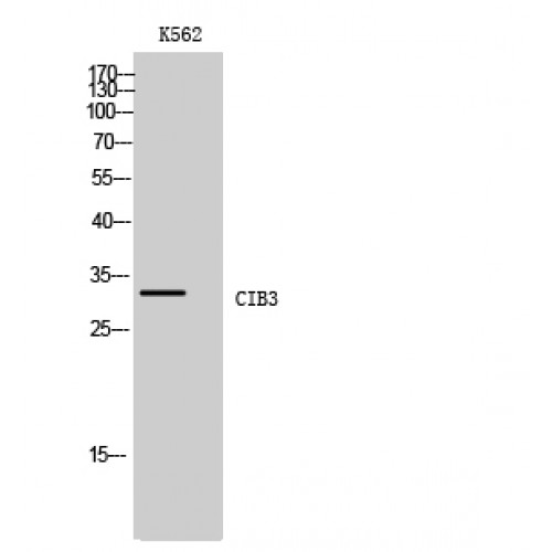 CIB3 Antibody - Western blot of CIB3 antibody