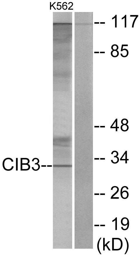 CIB3 Antibody - Western blot analysis of lysates from K562 cells, using CIB3 Antibody. The lane on the right is blocked with the synthesized peptide.
