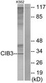 CIB3 Antibody - Western blot analysis of lysates from K562 cells, using CIB3 Antibody. The lane on the right is blocked with the synthesized peptide.