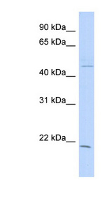 CIB3 Antibody - CIB3 antibody Western blot of Fetal Spleen lysate. This image was taken for the unconjugated form of this product. Other forms have not been tested.
