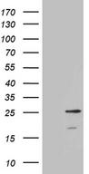 CIB3 Antibody - HEK293T cells were transfected with the pCMV6-ENTRY control. (Left lane) or pCMV6-ENTRY CIB3. (Right lane) cDNA for 48 hrs and lysed