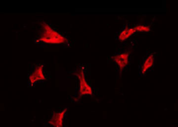 CIB3 Antibody - Staining HeLa cells by IF/ICC. The samples were fixed with PFA and permeabilized in 0.1% Triton X-100, then blocked in 10% serum for 45 min at 25°C. The primary antibody was diluted at 1:200 and incubated with the sample for 1 hour at 37°C. An Alexa Fluor 594 conjugated goat anti-rabbit IgG (H+L) Ab, diluted at 1/600, was used as the secondary antibody.