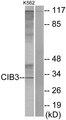 CIB3 Antibody - Western blot analysis of extracts from K562 cells, using CIB3 antibody.