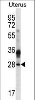CIB4 Antibody - CIB4 Antibody western blot of human normal Uterus tissue lysates (35 ug/lane). The CIB4 antibody detected the CIB4 protein (arrow).