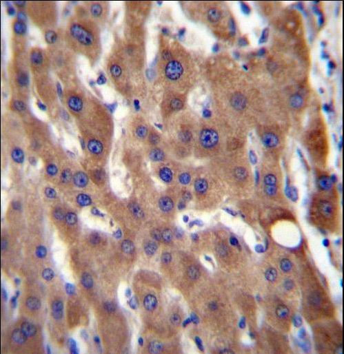 CIB4 Antibody - CIB4 Antibody immunohistochemistry of formalin-fixed and paraffin-embedded human liver tissue followed by peroxidase-conjugated secondary antibody and DAB staining.