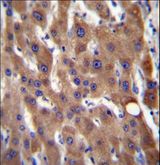CIB4 Antibody - CIB4 Antibody immunohistochemistry of formalin-fixed and paraffin-embedded human liver tissue followed by peroxidase-conjugated secondary antibody and DAB staining.