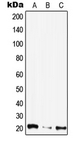 CIB4 Antibody - Western blot analysis of CIB4 expression in HepG2 (A); mouse kidney (B); rat liver (C) whole cell lysates.