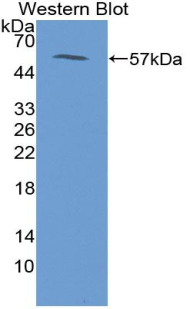 CIDEA / CIDE-A Antibody - Western blot of recombinant CIDEA / CIDE-A.