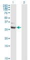 CIDEA / CIDE-A Antibody - Western Blot analysis of CIDEA expression in transfected 293T cell line by CIDEA monoclonal antibody (M01), clone 4B9.Lane 1: CIDEA transfected lysate(28.3 KDa).Lane 2: Non-transfected lysate.
