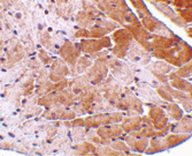 CIDEA / CIDE-A Antibody - Immunohistochemistry of CIDE-A in mouse heart tissue with CIDE-A antibody at 5 ug/ml.