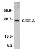 CIDEA / CIDE-A Antibody - Western blot of CIDE-A in murine heart tissue lysate with CIDE-A antibody at 1:500 dilution.