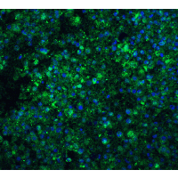 CIDEA / CIDE-A Antibody - Immunofluorescence of CIDE-A in human brain tissue with CIDE A antibody at 20 µg/mL.Green: CIDE-A Antibody  Blue: DAPI staining