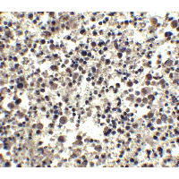 CIDEA / CIDE-A Antibody - Immunohistochemistry of CIDE-A in human brain tissue with CIDE-A antibody at 2.5 µg/ml.