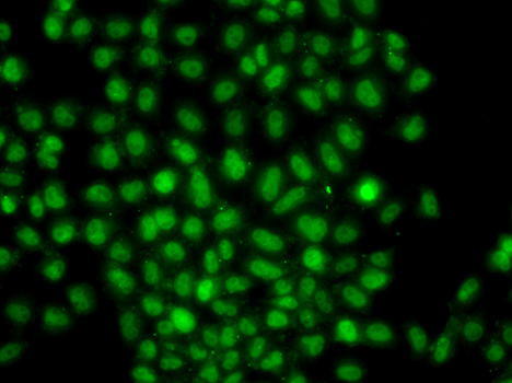 CIDEA / CIDE-A Antibody - Immunofluorescence analysis of A549 cells.