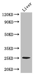 CIDEA / CIDE-A Antibody - Positive WB detected in:Mouse liver tissue;All lanes: CIDEA antibody at 3.4ug/ml;Secondary;Goat polyclonal to rabbit IgG at 1/50000 dilution;Predicted band size: 25 kDa;Observed band size: 25 kDa;