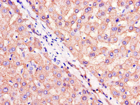 CIDEA / CIDE-A Antibody - Immunohistochemistry of paraffin-embedded human liver tissue using CIDEA Antibody at dilution of 1:100