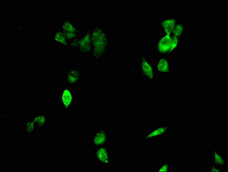 CIDEA / CIDE-A Antibody - Immunofluorescent analysis of Hela cells using CIDEA Antibody at a dilution of 1:100 and Alexa Fluor 488-congugated AffiniPure Goat Anti-Rabbit IgG(H+L)