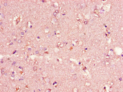 CIDEA / CIDE-A Antibody - Immunohistochemistry of paraffin-embedded human brain tissue using CIDEA Antibody at dilution of 1:100