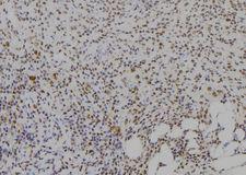 CIDEA / CIDE-A Antibody - 1:100 staining human spleen tissue by IHC-P. The sample was formaldehyde fixed and a heat mediated antigen retrieval step in citrate buffer was performed. The sample was then blocked and incubated with the antibody for 1.5 hours at 22°C. An HRP conjugated goat anti-rabbit antibody was used as the secondary.