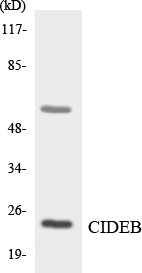 CIDEB Antibody - Western blot analysis of the lysates from COLO205 cells using CIDEB antibody.