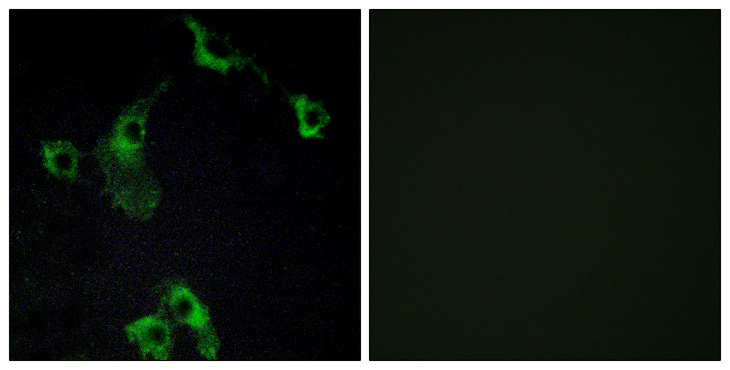 CIDEB Antibody - Immunofluorescence analysis of COS7 cells, using CIDEB Antibody. The picture on the right is blocked with the synthesized peptide.