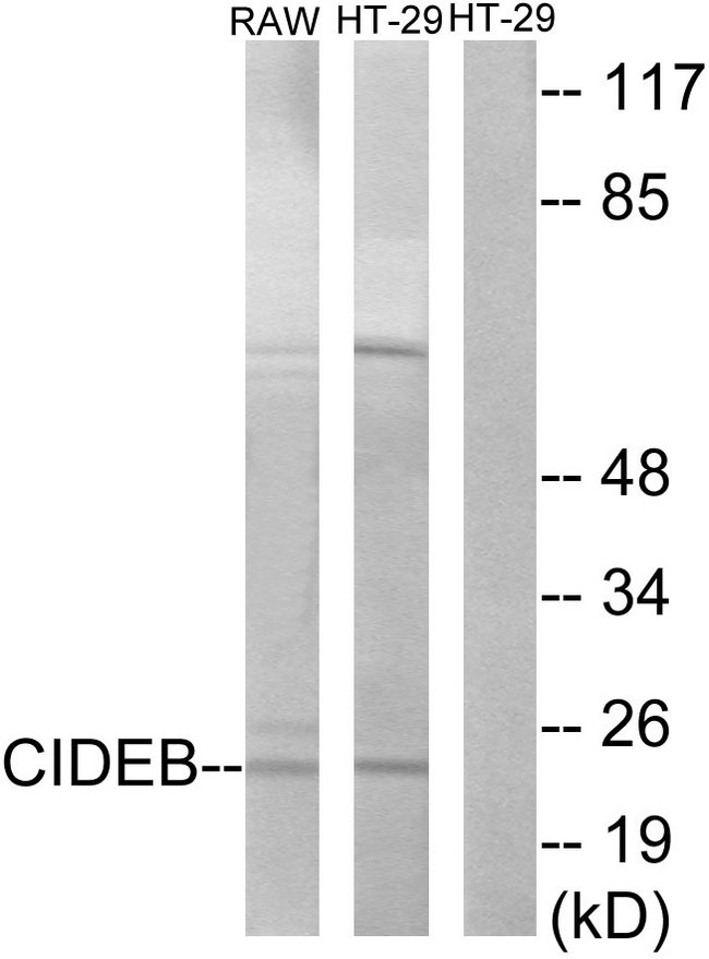 CIDEB Antibody - Western blot analysis of lysates from HT-29 and RAW264.7 cells, using CIDEB Antibody. The lane on the right is blocked with the synthesized peptide.