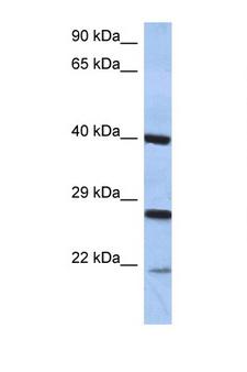CIDEB Antibody - CIDEB antibody Western blot of PANC1 Cell lysate. Antibody concentration 1 ug/ml. This image was taken for the unconjugated form of this product. Other forms have not been tested.